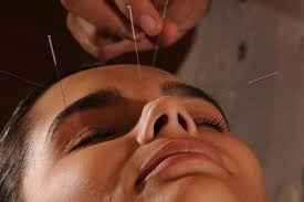 Acupuntura para dores crônicas