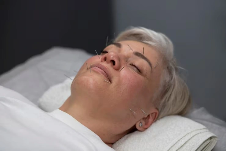 Tratamento de auriculoterapia